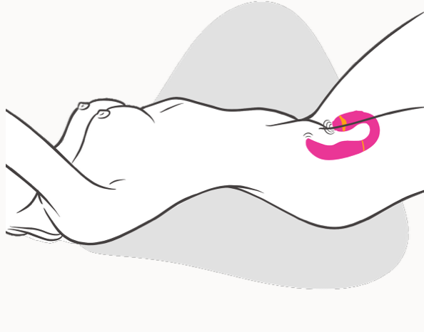 My-G by Adrien Lastic